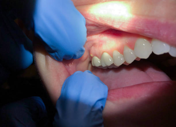 Best Emergency Dentist Near Me  in Laurel Lake, NJ