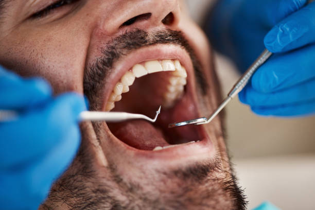 Best Chipped Tooth Repair Near Me  in Laurel Lake, NJ