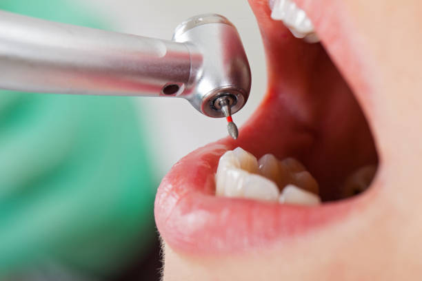 Best Tooth Infection Emergency Dentist  in Laurel Lake, NJ